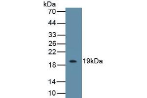 Detection of Recombinant IL18BP, Mouse using Polyclonal Antibody to Interleukin 18 Binding Protein (IL18BP) (IL18BP antibody  (AA 29-193))