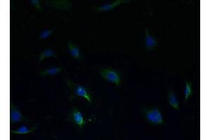 Immunofluorescent analysis of HepG2 cells using ABIN7170565 at dilution of 1:100 and Alexa Fluor 488-congugated AffiniPure Goat Anti-Rabbit IgG(H+L) (S1PR1 antibody  (AA 311-382))