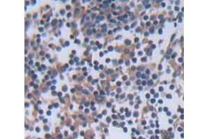 Figure. (BTK antibody  (AA 1-168))