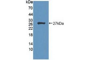 Detection of Recombinant HIPK2, Human using Polyclonal Antibody to Homeodomain Interacting Protein Kinase 2 (HIPK2) (HIPK2 antibody  (AA 977-1198))
