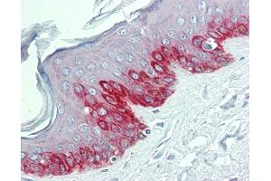 Anti-HDX antibody IHC of human skin. (HDX antibody  (N-Term))