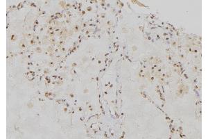 ABIN6276555 at 1/100 staining Human lung tissue by IHC-P. (RRM1 antibody  (Internal Region))