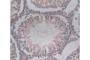 Detection of CBG in Rat Testis Tissue using Monoclonal Antibody to Corticosteroid Binding Globulin (CBG) (SERPINA6 antibody  (AA 173-344))