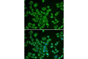 Immunofluorescence (IF) image for anti-SMAD, Mothers Against DPP Homolog 1 (SMAD1) (AA 20-240) antibody (ABIN3021439)