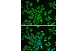 Immunofluorescence (IF) image for anti-SMAD, Mothers Against DPP Homolog 1 (SMAD1) (AA 20-240) antibody (ABIN6215035) (SMAD1 antibody  (AA 20-240))