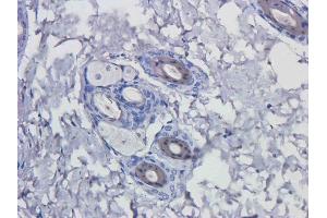 Immunohistochemistry (IHC) image for anti-EGFR (Matuzumab Biosimilar) (Extracellular Domain) antibody (ABIN5668060)