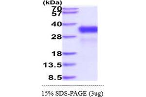 SDS-PAGE (SDS) image for Retinoic Acid Early Transcript 1E (RAET1E) (AA 31-225) protein (His tag) (ABIN6388090) (Retinoic Acid Early Transcript 1E (RAET1E) (AA 31-225) protein (His tag))