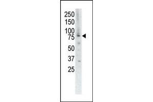 Western blot analysis of anti-MUSK Pab (ABIN392020 and ABIN2841796) in placenta cell lysate. (MUSK antibody  (C-Term))