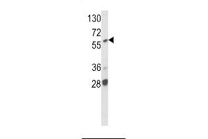 Western blot analysis of hARAF1- (ABIN392244 and ABIN2841935) in MCF7 cell line lysates (35 μg/lane).