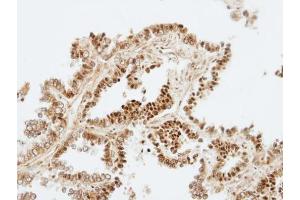 IHC-P Image Immunohistochemical analysis of paraffin-embedded human normal lung, using ZKSCAN3, antibody at 1:100 dilution.