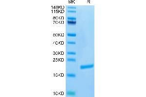 Biotinylated Human FGF-7/KGF on Tris-Bis PAGE under reduced condition. (FGF7 Protein (AA 32-194) (His tag,Biotin))