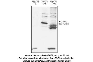 Image no. 1 for anti-ATP-Binding Cassette, Sub-Family G (WHITE), Member 8 (ABCG8) (N-Term) antibody (ABIN363412) (ABCG8 antibody  (N-Term))