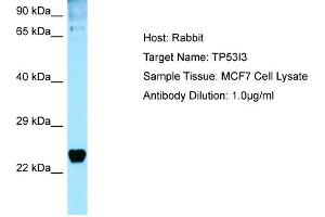 Western Blotting (WB) image for anti-Tumor Protein P53 Inducible Protein 3 (TP53I3) (C-Term) antibody (ABIN2789865) (TP53I3 antibody  (C-Term))
