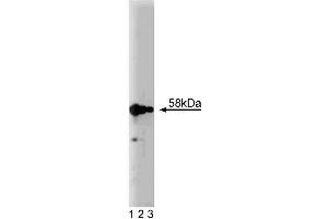 Western blot analysis of Karyopherin alpha on a HeLa cell lysate (Human cervical epitheloid carcinoma, ATCC CCL-2. (KPNA2 antibody  (AA 254-497))