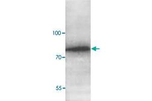 Western blot analysis of human fetal liver lysate with ABCG8 polyclonal antibody  at 1 : 1000 dilution. (ABCG8 antibody  (C-Term))