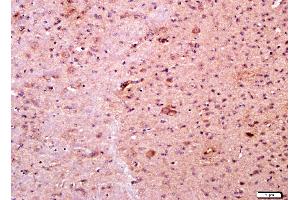 Immunohistochemistry (Paraffin-embedded Sections) (IHC (p)) image for anti-Tumor Necrosis Factor Receptor Superfamily, Member 11a, NFKB Activator (TNFRSF11A) (AA 101-200) antibody (ABIN1714635)