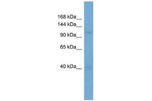 Western Blot showing RANBP5 antibody used at a concentration of 1-2 ug/ml to detect its target protein. (Importin 5 antibody  (N-Term))