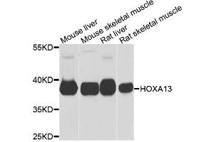 Western blot analysis of extracts of various cell lines, using HOXA13 antibody. (HOXA13 antibody  (AA 140-320))