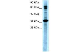 Western Blotting (WB) image for anti-TGF-beta Activated Kinase 1/MAP3K7 Binding Protein 2 (TAB2) (N-Term) antibody (ABIN2779619)