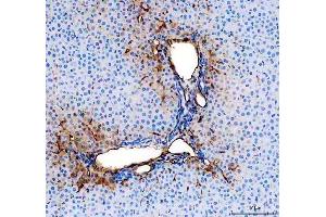 IHC analysis of CD31/Pecam1 using anti-CD31/Pecam1 antibody (ABIN7601662).