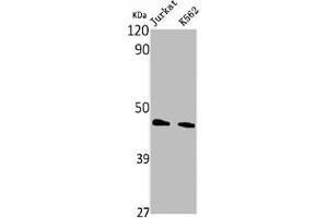 PHKG1 antibody  (Internal Region)