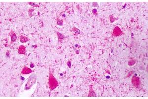Anti-GPRC5A / RAI3 antibody IHC staining of human brain, neurons. (GPRC5A antibody  (C-Term))