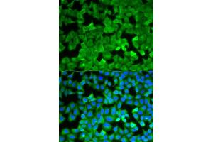 Immunofluorescence analysis of A549 cells using ASNS antibody. (Asparagine Synthetase antibody  (AA 262-561))