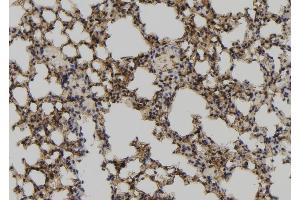 ABIN6267136 at 1/100 staining Mouse lung tissue by IHC-P. (MCM3 antibody  (pSer112))