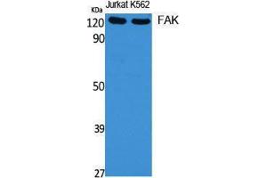 Western Blotting (WB) image for anti-PTK2 Protein tyrosine Kinase 2 (PTK2) (Thr450) antibody (ABIN3184584) (FAK antibody  (Thr450))