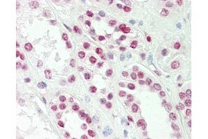 Anti-TLX1 / HOX11 antibody IHC staining of human kidney. (TLX1 antibody  (AA 163-191))