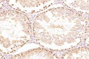 Immunohistochemistry analysis of paraffin-embedded mouse testis using,ZSCAN20 (ABIN7076252) at dilution of 1: 3000 (ZSCAN20 antibody)