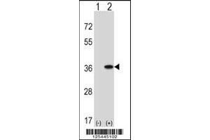 Western blot analysis of GNAQ using rabbit polyclonal GNAQ Antibody using 293 cell lysates (2 ug/lane) either nontransfected (Lane 1) or transiently transfected (Lane 2) with the GNAQ gene.