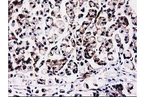 Immunohistochemistry (IHC) image for anti-Striatin Interacting Protein 1 (STRIP1) antibody (ABIN1498204)