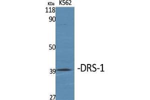 Western Blot (WB) analysis of specific cells using DRS-1 Polyclonal Antibody. (DDX27 antibody  (Internal Region))