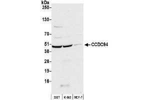 anti-Coiled-Coil Domain Containing 94 (CCDC94) (AA 273-323) antibody