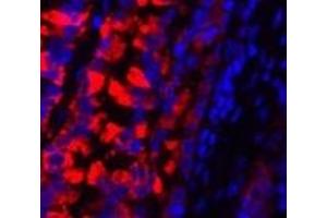 Immunofluorescence analysis of Rat lung tissue using MMP2 Polyclonal Antibody at dilution of 1:200. (MMP2 antibody)