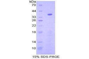 SDS-PAGE analysis of Mouse GSK3a Protein. (GSK3 alpha Protein)