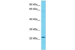 Host: Rabbit Target Name: CXorf56 Sample Type: Fetal Heart lysates Antibody Dilution: 1.