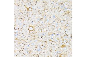 Immunohistochemistry of paraffin-embedded mouse brain using βIII-Tubulin/β3-Tubulin  at dilution of 100 (40x lens). (TUBB3 antibody)