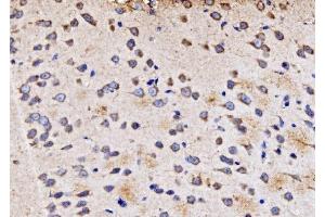 IHC analysis of PMPCA/INPP5 using anti-PMPCA/INPP5 antibody (ABIN7602722). (PMPCA antibody  (AA 99-525))