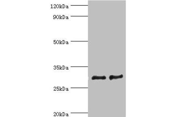 ATP5F1 anticorps  (AA 1-245)