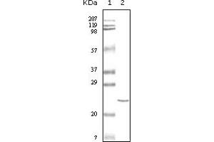 Western Blotting (WB) image for anti-Cardiac Troponin I (TNNI3) (truncated) antibody (ABIN2464041) (TNNI3 antibody  (truncated))