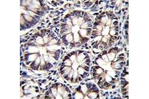 CTBP2 antibody immunohistochemistry analysis in formalin fixed and paraffin embedded human rectum tissue. (CTBP2 antibody  (AA 1-30))