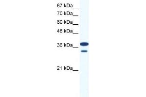 Human Jurkat; WB Suggested Anti-LHX3 Antibody Titration: 0. (LHX3 antibody  (Middle Region))