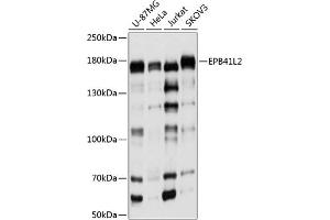 Western blot analysis of extracts of various cell lines, using EPB41L2 antibody (ABIN6131606, ABIN6140199, ABIN6140200 and ABIN6224888) at 1:1000 dilution. (EPB41L2 antibody  (AA 1-210))