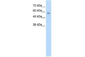 WB Suggested Anti-C20orf18 Antibody Titration:  1. (RBCK1 antibody  (Middle Region))