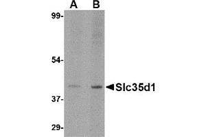 Western Blotting (WB) image for anti-Solute Carrier Family 35 (UDP-Glucuronic Acid/UDP-N-Acetylgalactosamine Dual Transporter), Member D1 (SLC35D1) (N-Term) antibody (ABIN1031577) (SLC35D1 antibody  (N-Term))