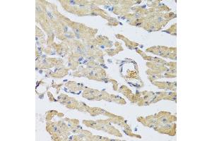 Immunohistochemistry of paraffin-embedded mouse heart using UCN2 antibody (ABIN5973879) at dilution of 1/100 (40x lens). (Urocortin 2 antibody)