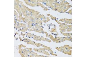 Immunohistochemistry of paraffin-embedded mouse heart using UCN2 antibody (ABIN5973879) at dilution of 1/100 (40x lens).