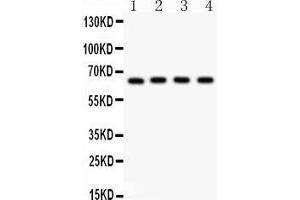 Anti- NF-kB p65 Picoband antibody, Western blottingAll lanes: Anti NF-kB p65  at 0. (NF-kB p65 antibody  (AA 291-479))